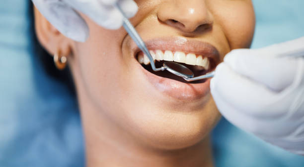 Best Dental Fillings (Composite and Amalgam)  in Temple Terrace, FL